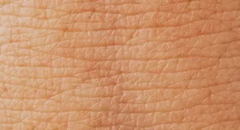 Conocé a la epidermis, la primera defensa de la piel